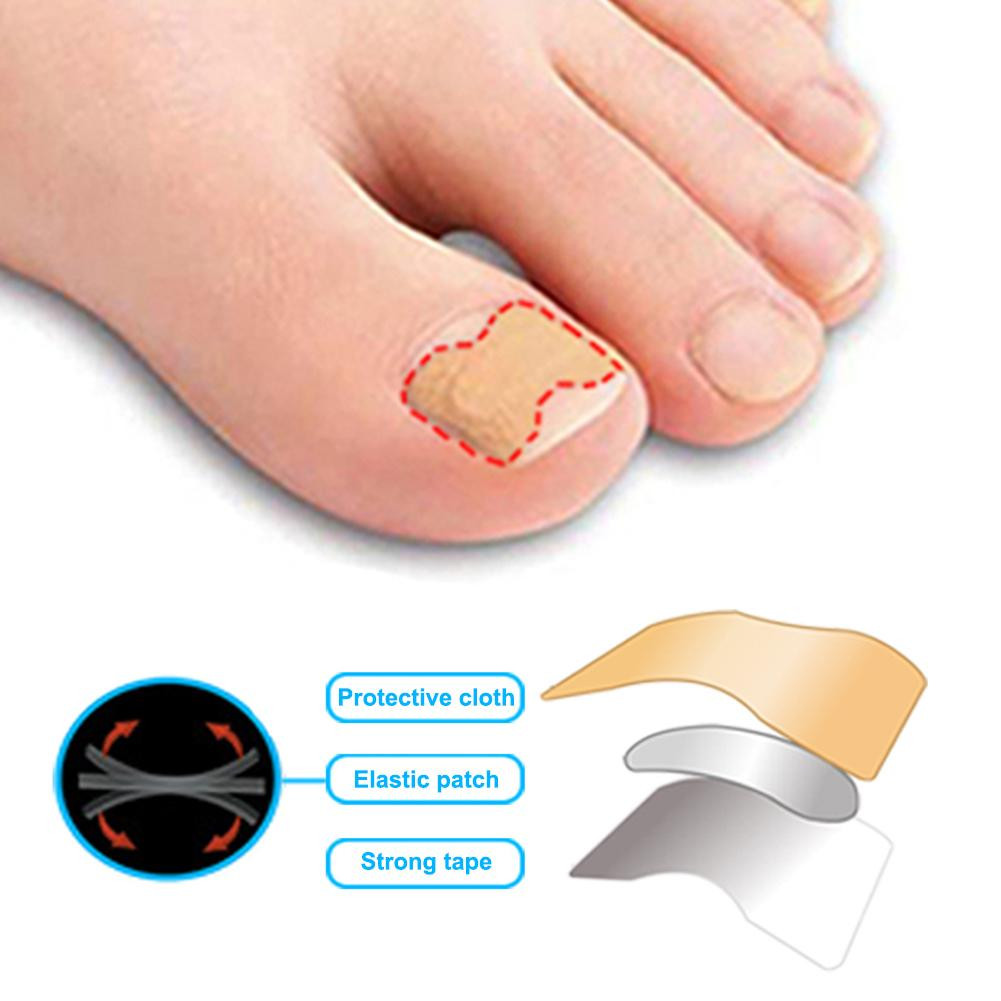 Miniatura 3 de PARCHE PARA DEDOS ENCARNADOS